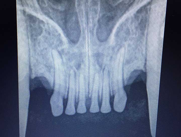 Cat Dental Xray